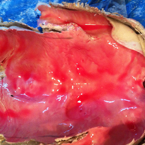 Body Casting